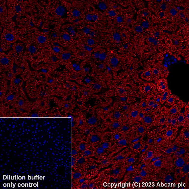 Immunohistochemistry (Formalin/PFA-fixed paraffin-embedded sections) - Alexa Fluor® 647 Anti-GPCR LGR6 antibody [EPR6874] (AB315362)