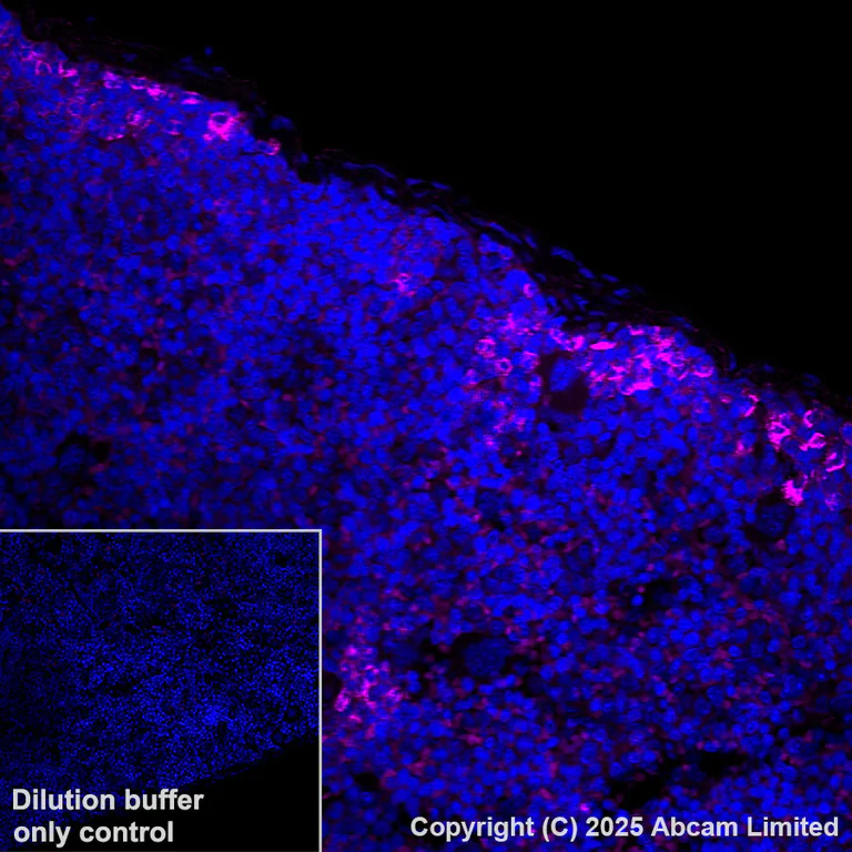 Immunohistochemistry (Formalin/PFA-fixed paraffin-embedded sections) - Alexa Fluor® 647 Anti-GPNMB antibody [EPR29063-10] (AB325224)