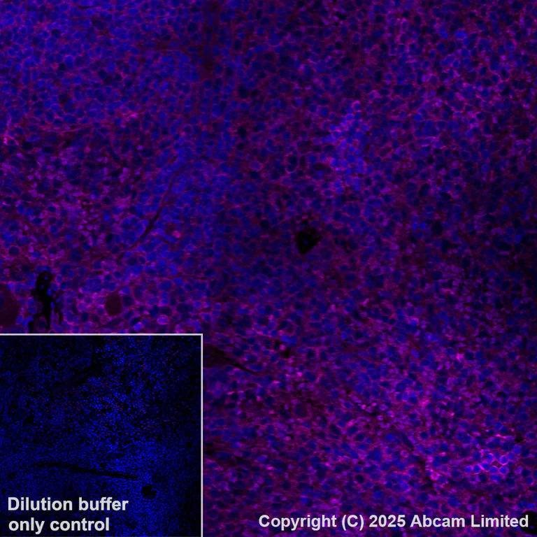 Immunohistochemistry (Formalin/PFA-fixed paraffin-embedded sections) - Alexa Fluor® 647 Anti-GPNMB antibody [EPR29063-10] (AB325224)