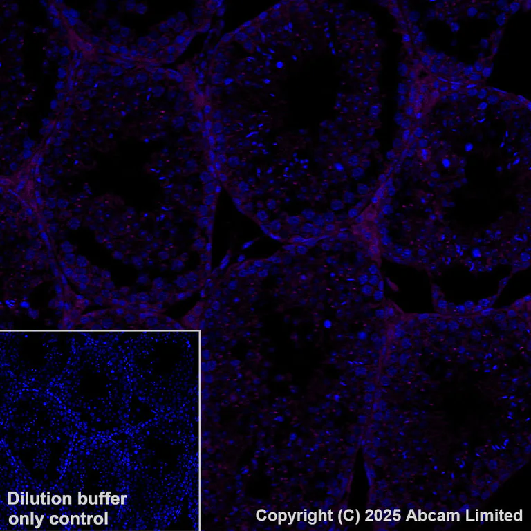 Immunohistochemistry (Formalin/PFA-fixed paraffin-embedded sections) - Alexa Fluor® 647 Anti-GPNMB antibody [EPR29063-10] (AB325224)