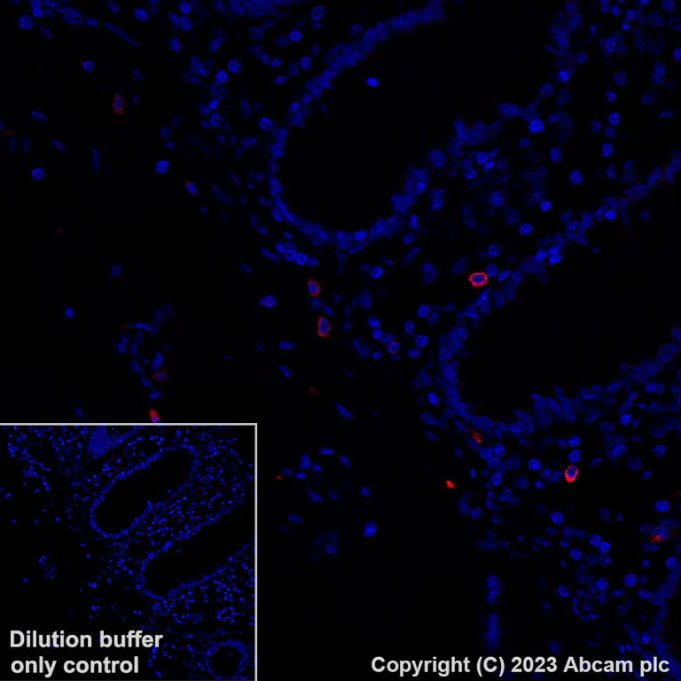 Immunohistochemistry (Formalin/PFA-fixed paraffin-embedded sections) - Alexa Fluor® 647 Anti-Granzyme B antibody [EPR20129-217] (AB225473)
