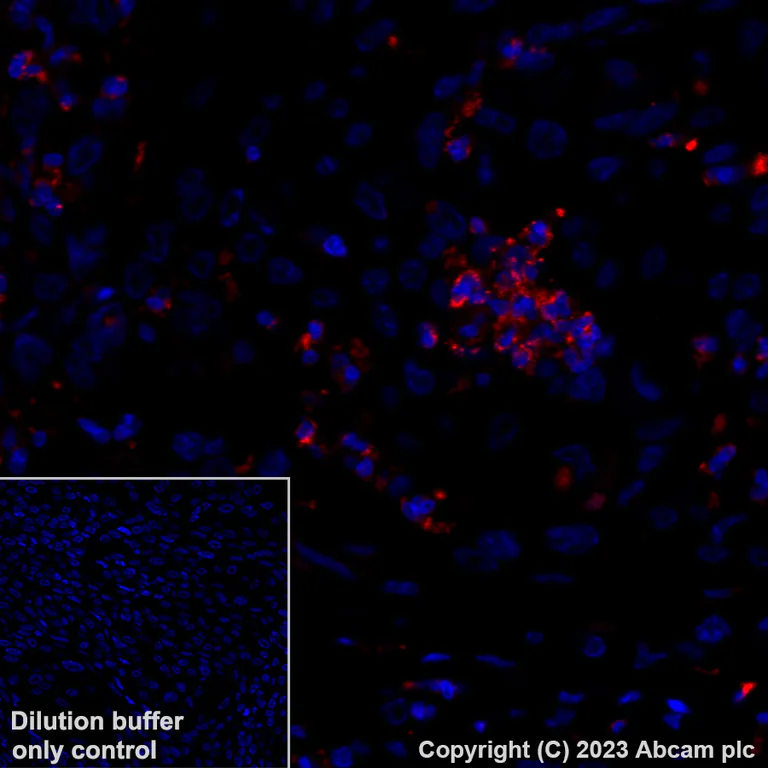 Immunohistochemistry (Formalin/PFA-fixed paraffin-embedded sections) - Alexa Fluor® 647 Anti-Granzyme B antibody [EPR20129-217] (AB225473)