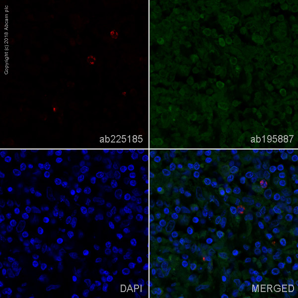 Immunohistochemistry (Formalin/PFA-fixed paraffin-embedded sections) - Alexa Fluor® 647 Anti-Granzyme B antibody [EPR8260] (AB225185), expandable thumbnail