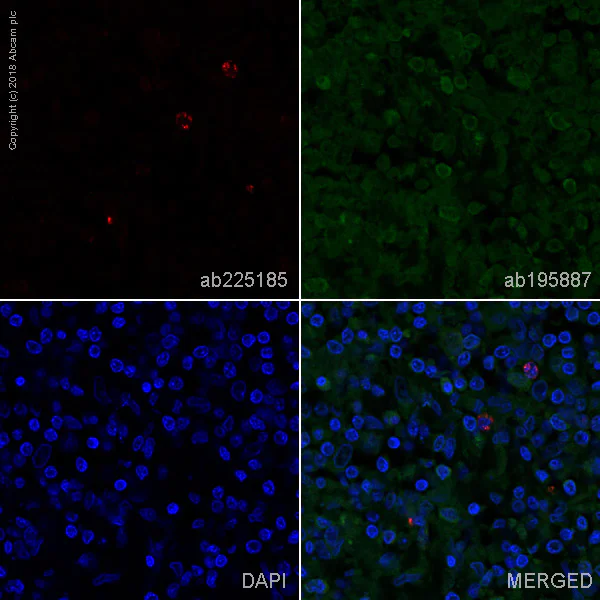 Immunohistochemistry (Formalin/PFA-fixed paraffin-embedded sections) - Alexa Fluor® 647 Anti-Granzyme B antibody [EPR8260] (AB225185)