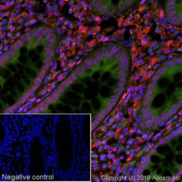 Immunohistochemistry (Formalin/PFA-fixed paraffin-embedded sections) - Alexa Fluor® 647 Anti-GRB2 antibody [Y237] (AB252038), expandable thumbnail