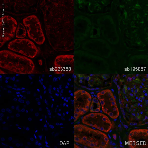 Immunohistochemistry (Formalin/PFA-fixed paraffin-embedded sections) - Alexa Fluor® 647 Anti-Hamartin antibody [EP318Y] (AB223388)
