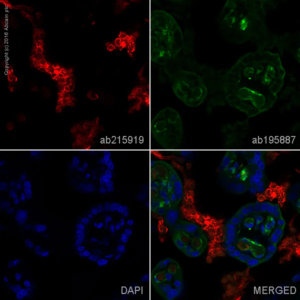 Immunohistochemistry (Formalin/PFA-fixed paraffin-embedded sections) - Alexa Fluor® 647 Anti-Hemoglobin subunit alpha antibody [EPR3608] (AB215919)