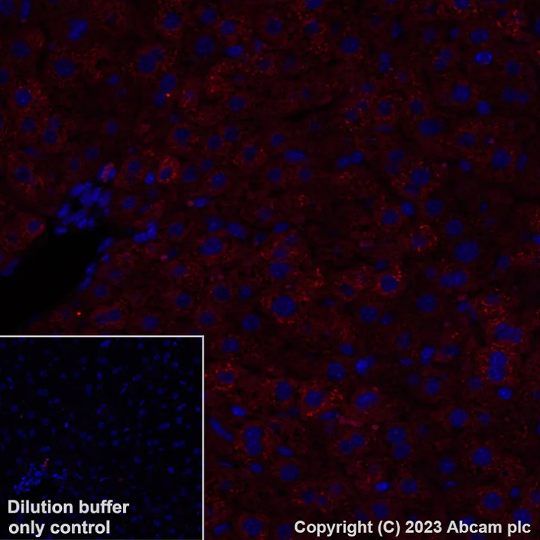 Immunohistochemistry (Formalin/PFA-fixed paraffin-embedded sections) - Alexa Fluor® 647 Anti-Hepcidin + Hepcidin-2 antibody [EPR18937] (AB315258)