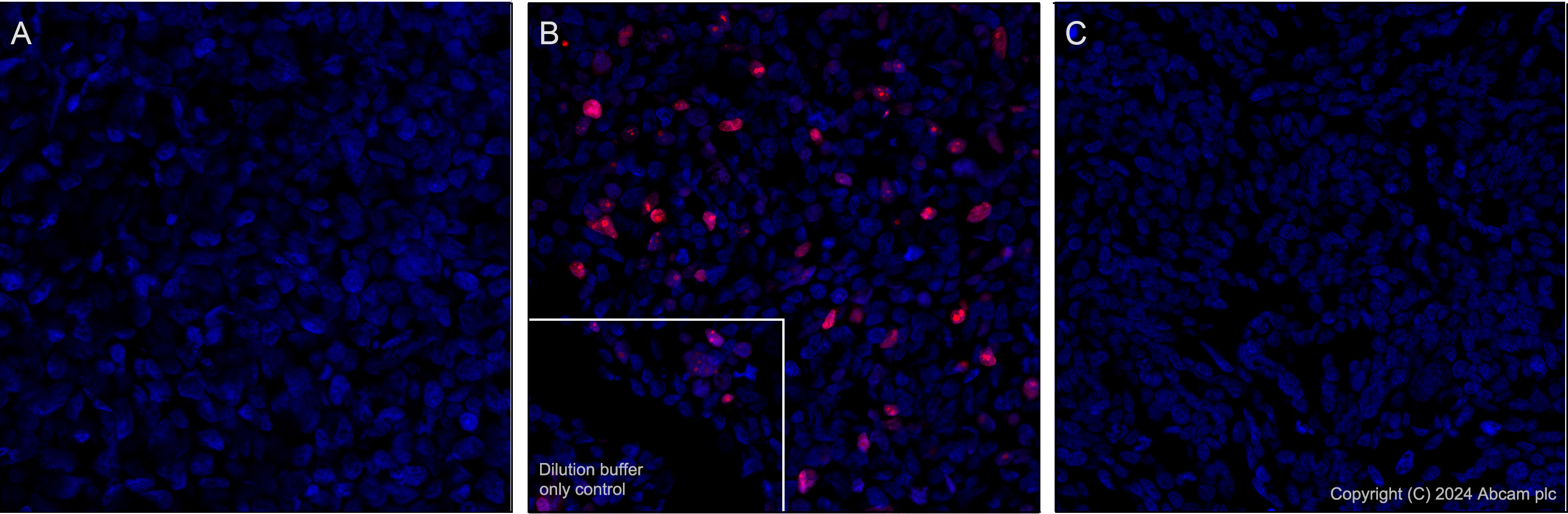 Immunohistochemistry (Formalin/PFA-fixed paraffin-embedded sections) - Alexa Fluor® 647 Anti-Histone H2B (mutated E76Q) antibody [EPR27299-85] (AB317717), expandable thumbnail
