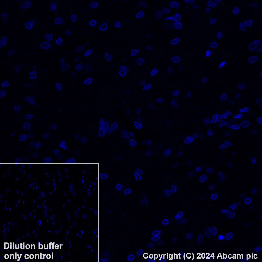 Immunohistochemistry (Formalin/PFA-fixed paraffin-embedded sections) - Alexa Fluor® 647 Anti-Histone H2B (mutated E76Q) antibody [EPR27299-85] (AB317717), expandable thumbnail