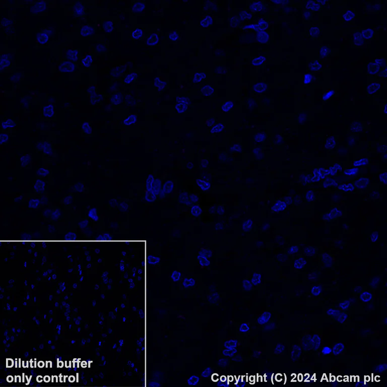 Immunohistochemistry (Formalin/PFA-fixed paraffin-embedded sections) - Alexa Fluor® 647 Anti-Histone H2B (mutated E76Q) antibody [EPR27299-85] (AB317717)