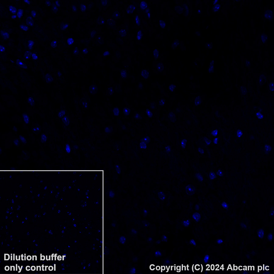 Immunohistochemistry (Formalin/PFA-fixed paraffin-embedded sections) - Alexa Fluor® 647 Anti-Histone H2B (mutated E76Q) antibody [EPR27299-85] (AB317717), expandable thumbnail