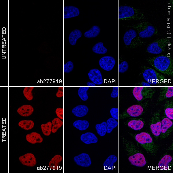 Immunocytochemistry - Alexa Fluor® 647 Anti-Histone H3 (acetyl K14) antibody [EP964Y] (AB277919), expandable thumbnail
