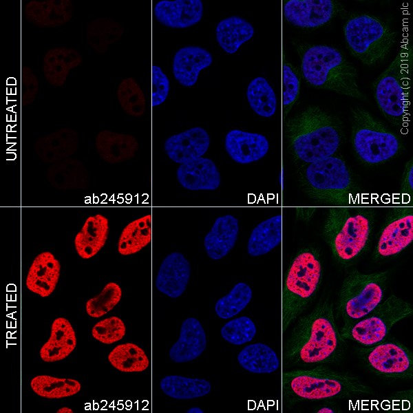 Immunocytochemistry/ Immunofluorescence - Alexa Fluor® 647 Anti-Histone H3 (acetyl K27) antibody [EP16602] (AB245912)