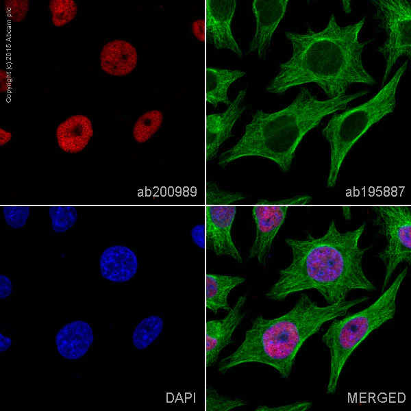Immunocytochemistry/ Immunofluorescence - Alexa Fluor® 647 Anti-Histone H3 (acetyl K9) antibody [Y28] (AB200989)