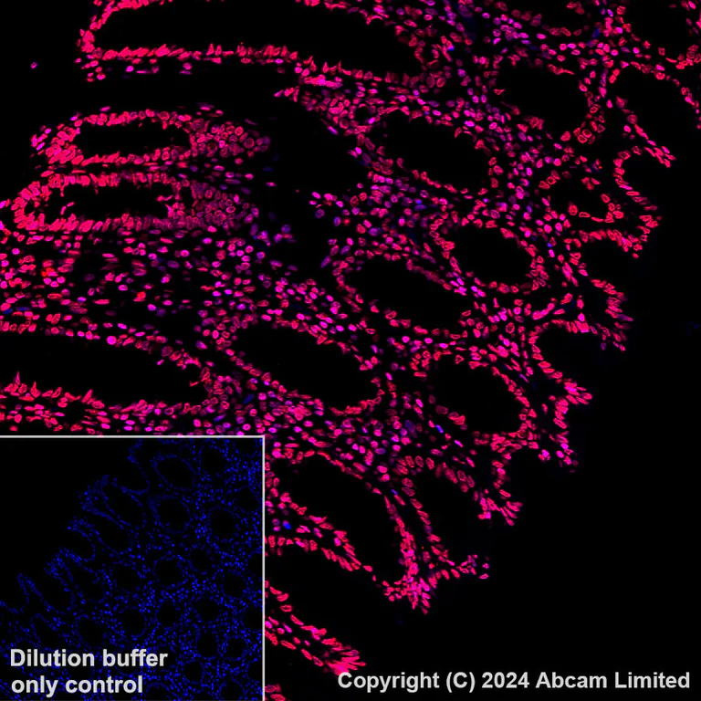Immunohistochemistry (Formalin/PFA-fixed paraffin-embedded sections) - Alexa Fluor® 647 Anti-Histone H3 antibody [EPR16987] - Nuclear Marker (AB207543)