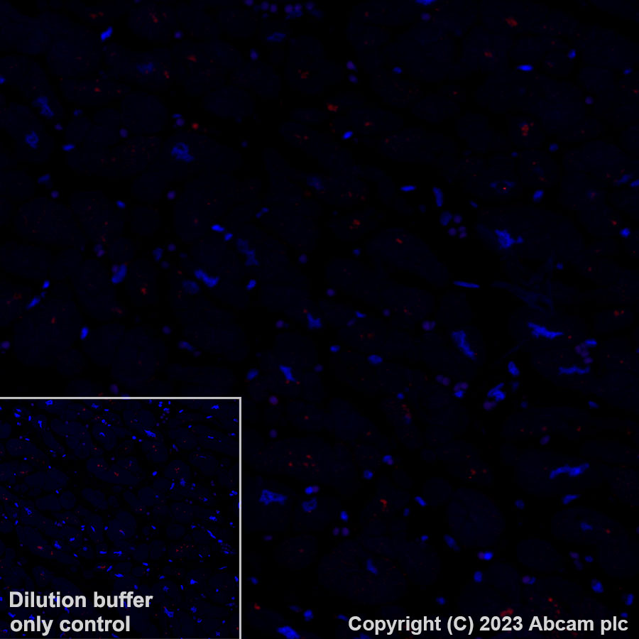 Immunohistochemistry (Formalin/PFA-fixed paraffin-embedded sections) - Alexa Fluor® 647 Anti-HLA Class 1 ABC antibody [EPR22172] (AB315134)