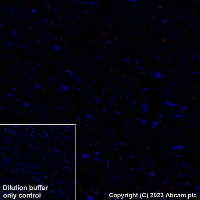 Immunohistochemistry (Formalin/PFA-fixed paraffin-embedded sections) - Alexa Fluor® 647 Anti-HLA Class 1 ABC antibody [EPR22172] (AB315134)