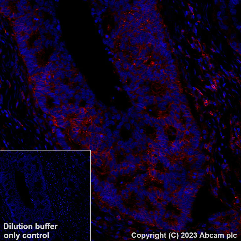 Immunohistochemistry (Formalin/PFA-fixed paraffin-embedded sections) - Alexa Fluor® 647 Anti-HLA Class 1 ABC antibody [EPR22172] (AB315134)