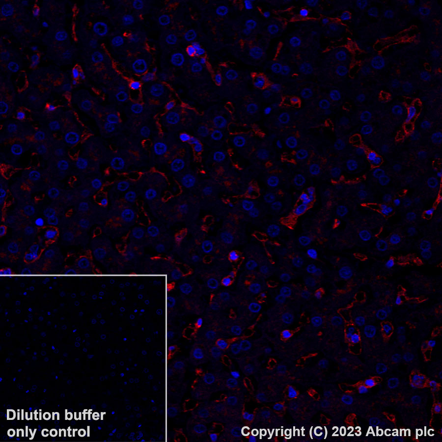 Immunohistochemistry (Formalin/PFA-fixed paraffin-embedded sections) - Alexa Fluor® 647 Anti-HLA Class 1 ABC antibody [EPR22172] (AB315134)