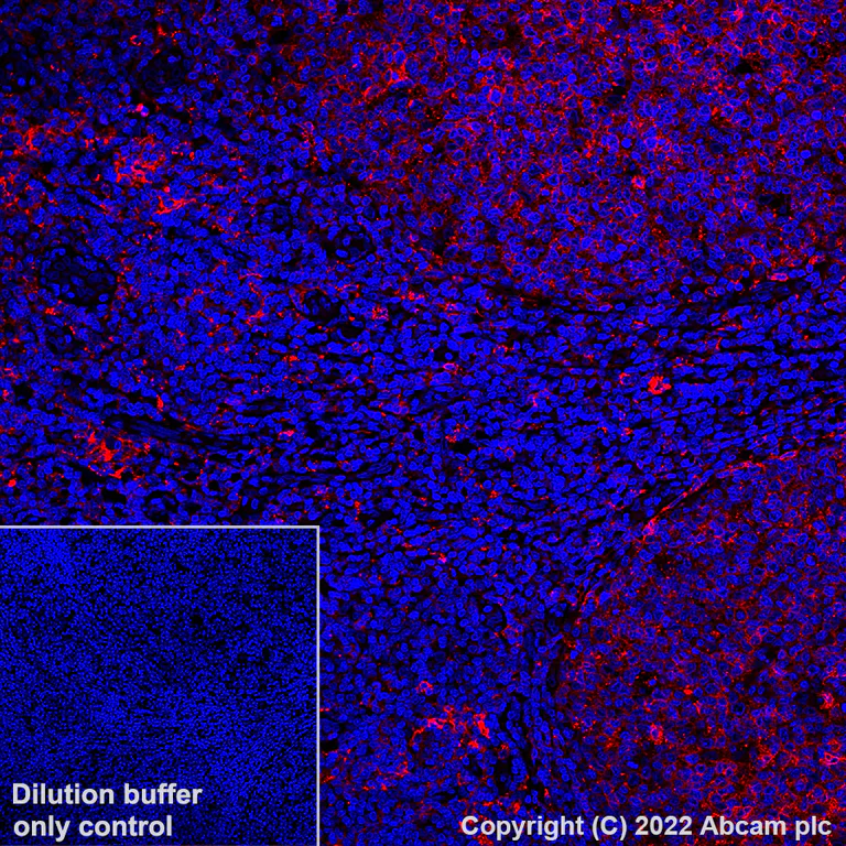 Immunohistochemistry (Formalin/PFA-fixed paraffin-embedded sections) - Alexa Fluor® 647 Anti-HLA-DR antibody [EPR3692] (AB307776)