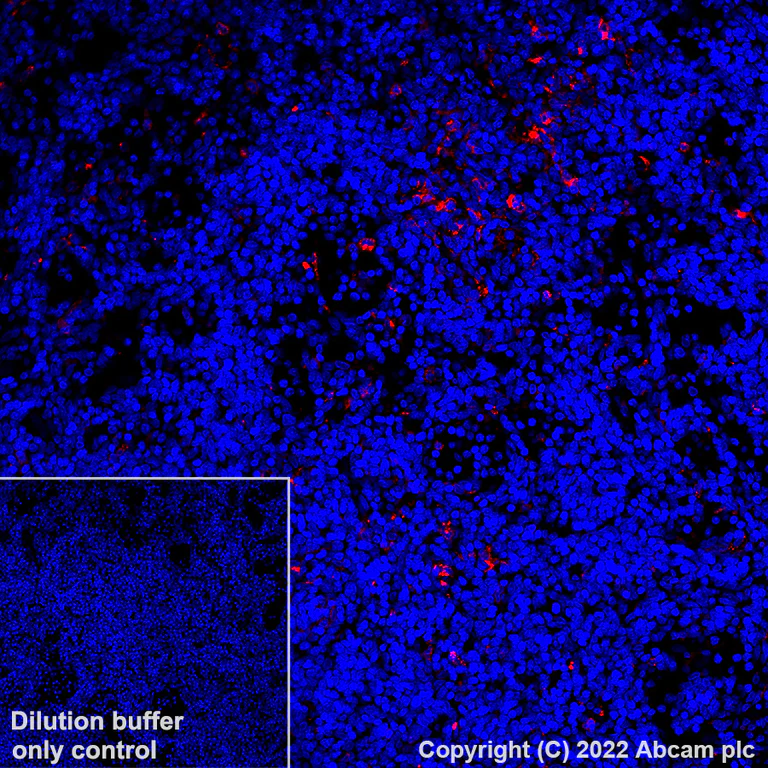 Immunohistochemistry (Formalin/PFA-fixed paraffin-embedded sections) - Alexa Fluor® 647 Anti-HLA-DR antibody [EPR3692] (AB307776)