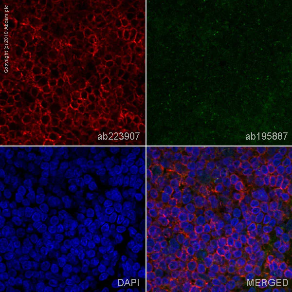 Immunohistochemistry (Frozen sections) - Alexa Fluor® 647 Anti-HLA-DR antibody [TAL 1B5] (AB223907)