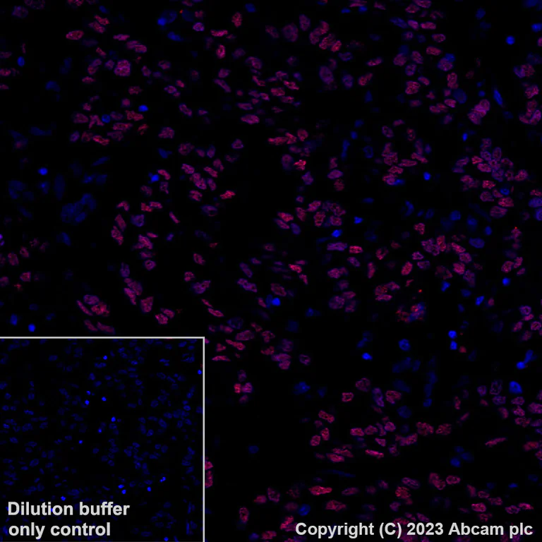 Immunohistochemistry (Formalin/PFA-fixed paraffin-embedded sections) - Alexa Fluor® 647 Anti-HNF-1B antibody [EPR18644-13] (AB314512)