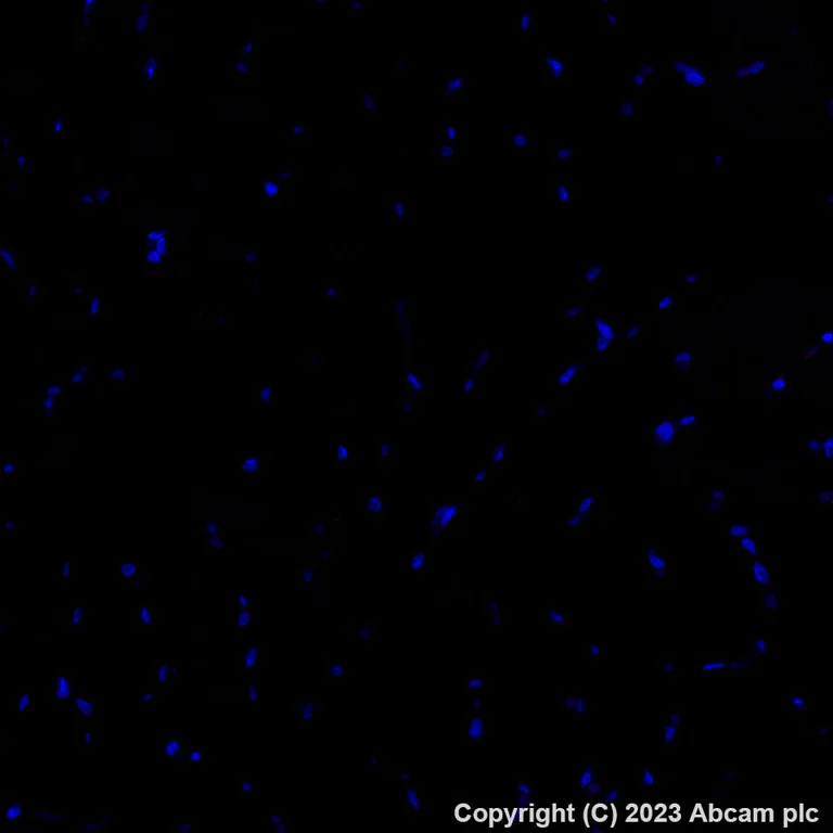 Immunohistochemistry (Formalin/PFA-fixed paraffin-embedded sections) - Alexa Fluor® 647 Anti-HNF-1B antibody [EPR18644-13] (AB314512)