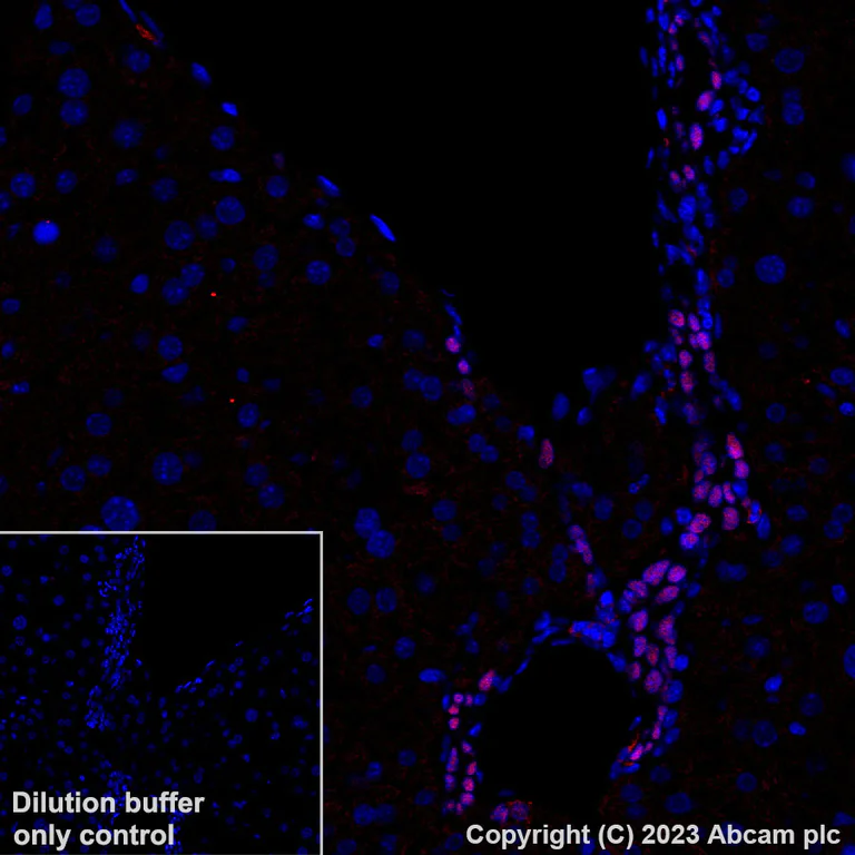 Immunohistochemistry (Formalin/PFA-fixed paraffin-embedded sections) - Alexa Fluor® 647 Anti-HNF-1B antibody [EPR18644-13] (AB314512)