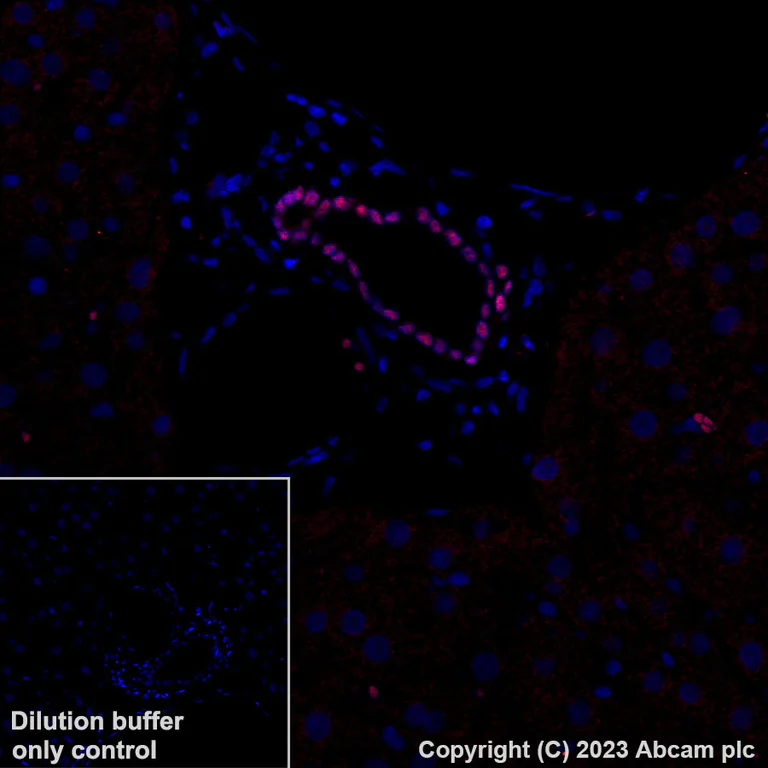 Immunohistochemistry (Formalin/PFA-fixed paraffin-embedded sections) - Alexa Fluor® 647 Anti-HNF-1B antibody [EPR18644-13] (AB314512)