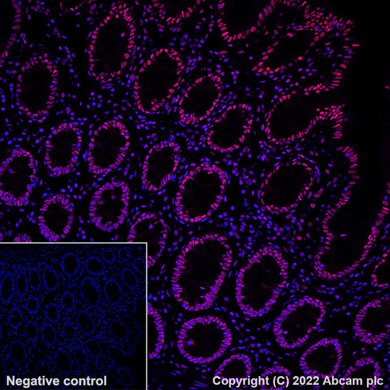 Immunohistochemistry (Formalin/PFA-fixed paraffin-embedded sections) - Alexa Fluor® 647 Anti-hnRNP A2B1 antibody [EPR24002-81] (AB300734)