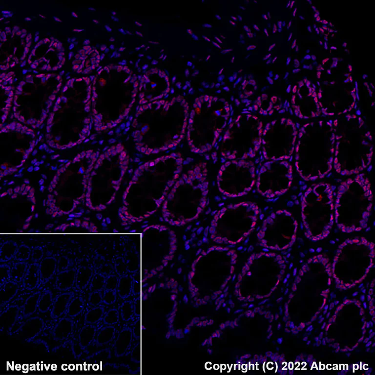Immunohistochemistry (Formalin/PFA-fixed paraffin-embedded sections) - Alexa Fluor® 647 Anti-hnRNP A2B1 antibody [EPR24002-81] (AB300734)