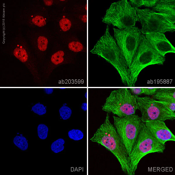 Immunocytochemistry/ Immunofluorescence - Alexa Fluor® 647 Anti-hnRNP K antibody [EP943Y] (AB203599)