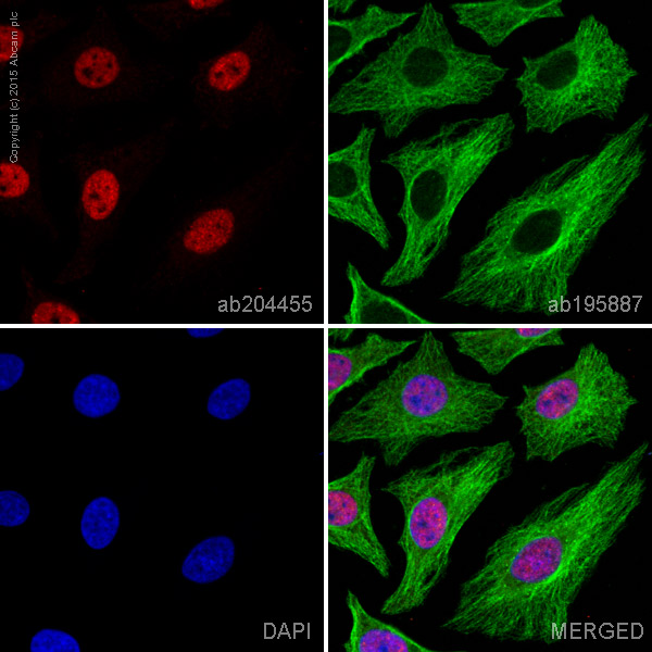 Immunocytochemistry/ Immunofluorescence - Alexa Fluor® 647 Anti-hnRNP K antibody [F45 P9 C7] (AB204455)