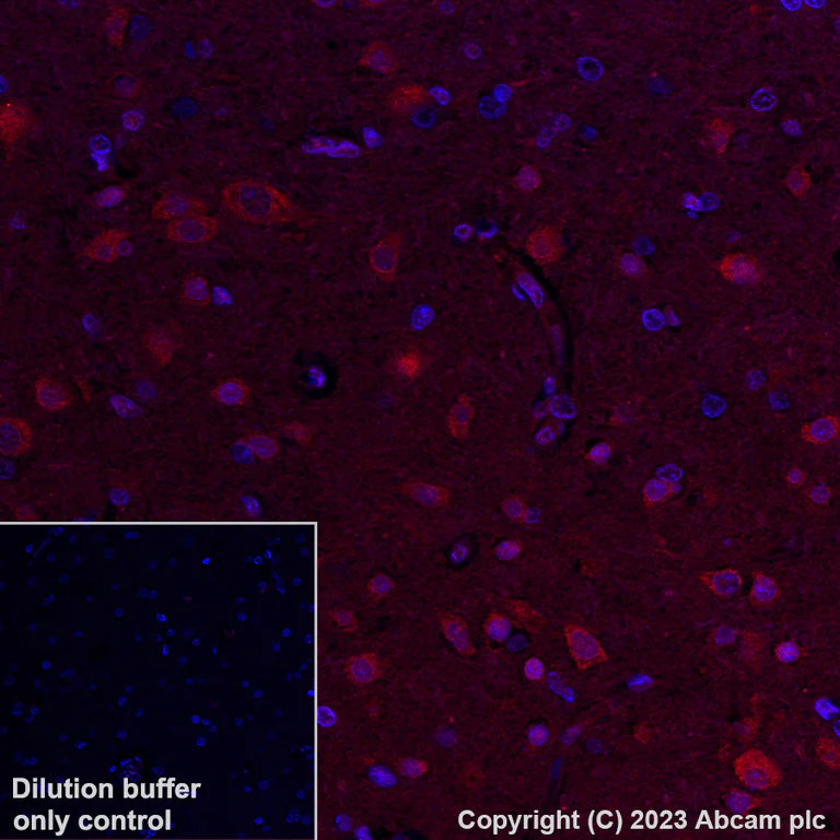 Immunohistochemistry (Formalin/PFA-fixed paraffin-embedded sections) - Alexa Fluor® 647 Anti-Hsp70 antibody [3A3] (AB309609)