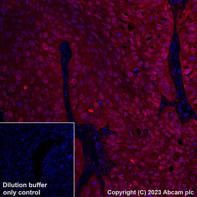 Immunohistochemistry (Formalin/PFA-fixed paraffin-embedded sections) - Alexa Fluor® 647 Anti-Hsp70 antibody [3A3] (AB309609)