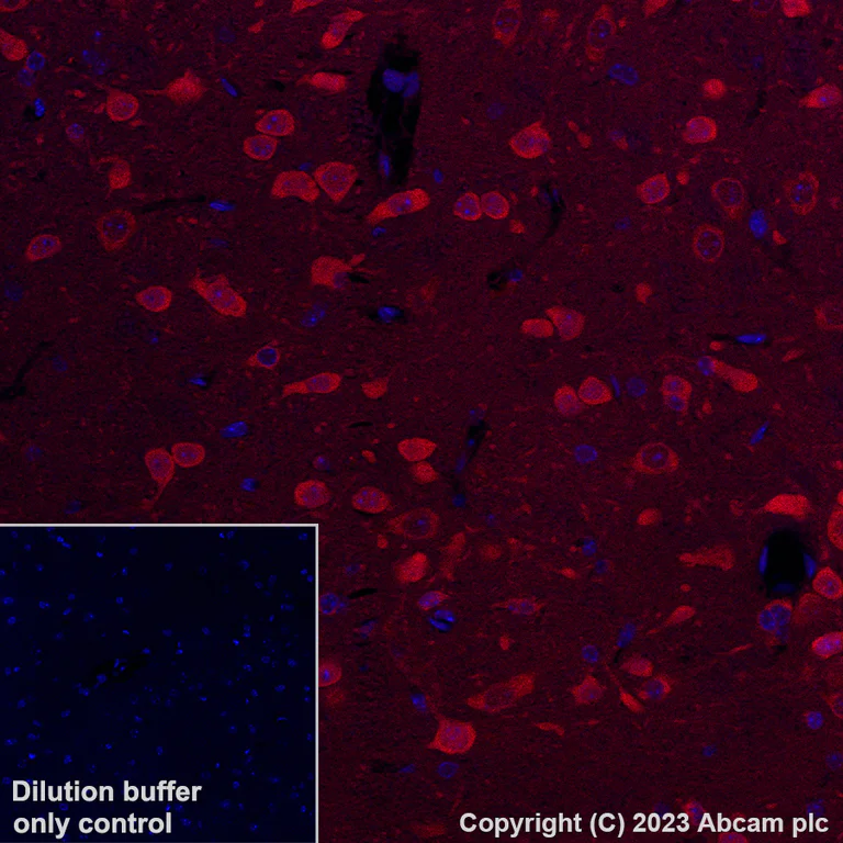 Immunohistochemistry (Formalin/PFA-fixed paraffin-embedded sections) - Alexa Fluor® 647 Anti-Hsp70 antibody [3A3] (AB309609)