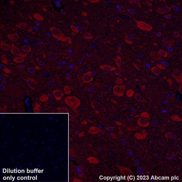 Immunohistochemistry (Formalin/PFA-fixed paraffin-embedded sections) - Alexa Fluor® 647 Anti-Hsp70 antibody [3A3] (AB309609)