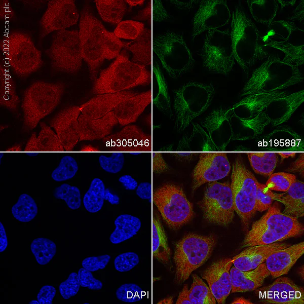 Immunocytochemistry/ Immunofluorescence - Alexa Fluor® 647 Anti-Hsp70 antibody [EPR16893] (AB305046)