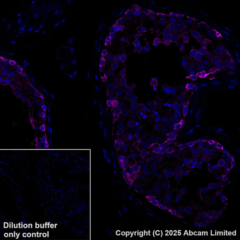 Immunohistochemistry (Formalin/PFA-fixed paraffin-embedded sections) - Alexa Fluor® 647 Anti-Hsp90 antibody [EPR16621-67] (AB223468)