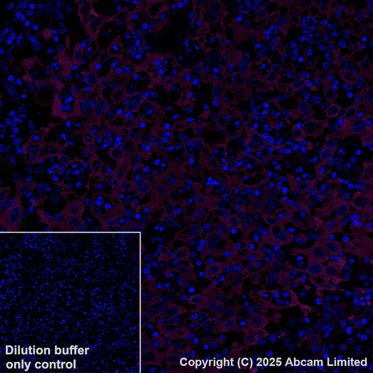 Immunohistochemistry (Formalin/PFA-fixed paraffin-embedded sections) - Alexa Fluor® 647 Anti-Hsp90 antibody [EPR16621-67] (AB223468)