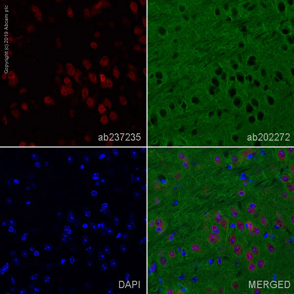 Immunohistochemistry (Formalin/PFA-fixed paraffin-embedded sections) - Alexa Fluor® 647 Anti-HuD + HuC antibody [EPR19098] (AB237235)