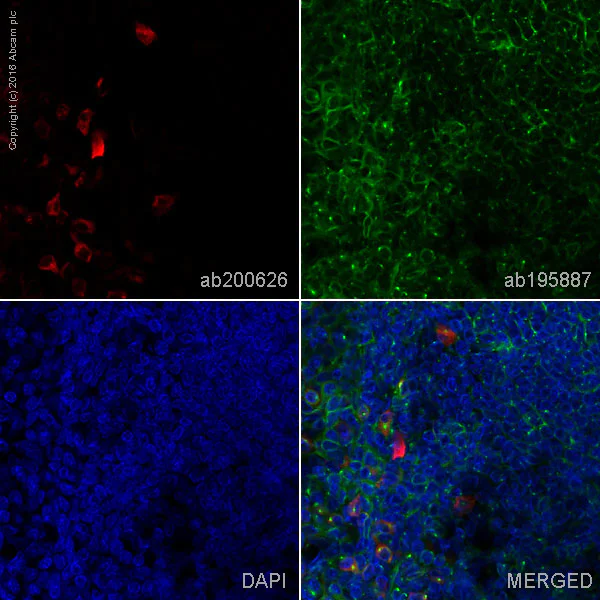 Immunohistochemistry (Formalin/PFA-fixed paraffin-embedded sections) - Alexa Fluor® 647 Anti-Human IgA antibody [EPSISR10] (AB200626)