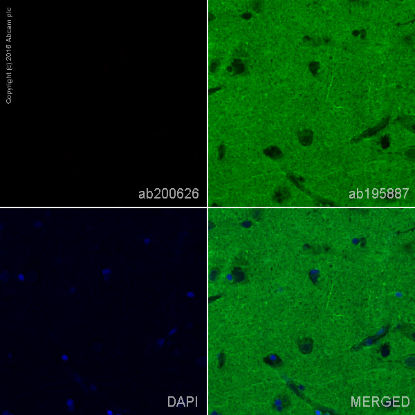 Immunohistochemistry (Formalin/PFA-fixed paraffin-embedded sections) - Alexa Fluor® 647 Anti-Human IgA antibody [EPSISR10] (AB200626), expandable thumbnail