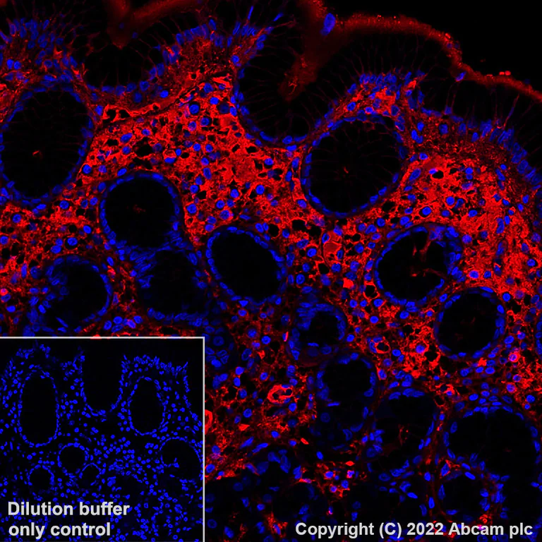 Immunohistochemistry - Alexa Fluor® 647 Anti-Human IgG antibody [EPR4421] (AB307521)