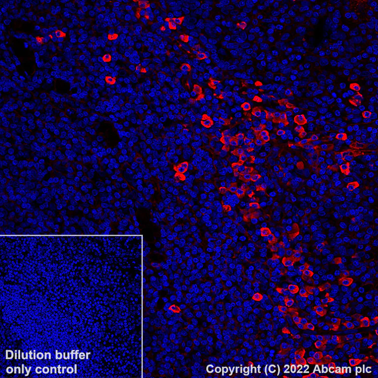 Immunohistochemistry - Alexa Fluor® 647 Anti-Human IgG antibody [EPR4421] (AB307521)