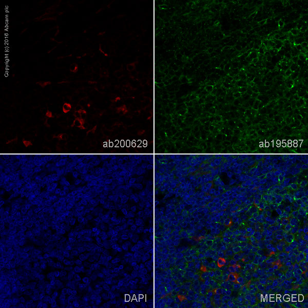Immunohistochemistry (Formalin/PFA-fixed paraffin-embedded sections) - Alexa Fluor® 647 Anti-Human IgM antibody [EPR5539-65-4] (AB200629), expandable thumbnail