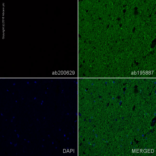 Immunohistochemistry (Formalin/PFA-fixed paraffin-embedded sections) - Alexa Fluor® 647 Anti-Human IgM antibody [EPR5539-65-4] (AB200629), expandable thumbnail