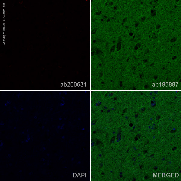 Immunohistochemistry (Formalin/PFA-fixed paraffin-embedded sections) - Alexa Fluor® 647 Anti-Human Kappa Chain antibody [EPR5539-71-8] (AB200631)